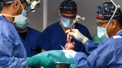 58χρονος γίνεται ο δεύτερος άνθρωπος που δέχεται μεταμόσχευση καρδιάς από γουρούνι