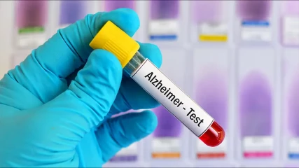 Αλτσχάιμερ: Νέες εξετάσεις αίματος εντοπίζουν την ασθένεια νωρίς