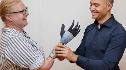 Επαναστατικό βιονικό χέρι συνδέεται σε οστά, μύες και νεύρα (ΕΙΚΟΝΕΣ)