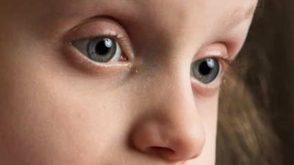 Τα μάτια του παιδιού μπορούν να αποκαλύψουν τον αυτισμό