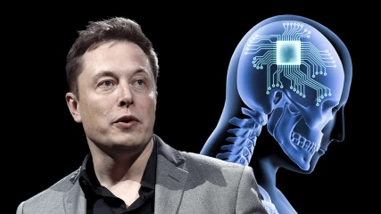 Έχουμε νεότερα από τον πρώτο άνθρωπο που έβαλε τσιπάκι στον εγκέφαλό του από την Neuralink του Elon Musk