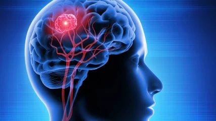 Πειραματική θεραπεία εξαφάνισε όγκο στον εγκέφαλο σε λίγες μέρες