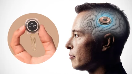 Neuralink: Η εταιρία του Elon Musk ετοιμάζει τσιπάκι για τον εγκέφαλο που θα κάνει τυφλούς να βλέπουν