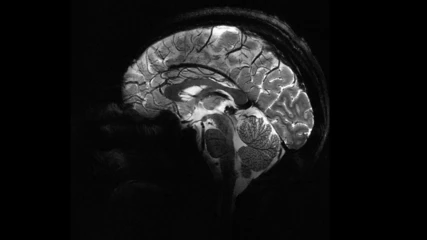 Αυτός είναι ο εγκέφαλός μας, όπως τον βλέπει ο ισχυρότερος μαγνητικός τομογράφος στον κόσμο