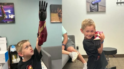 Πεντάχρονος φόρεσε το βιονικό χέρι του Iron Man (ΕΙΚΟΝΕΣ)