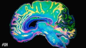 Το Brainprint είναι η νέα μορφή βιομετρικών χαρακτηριστικών