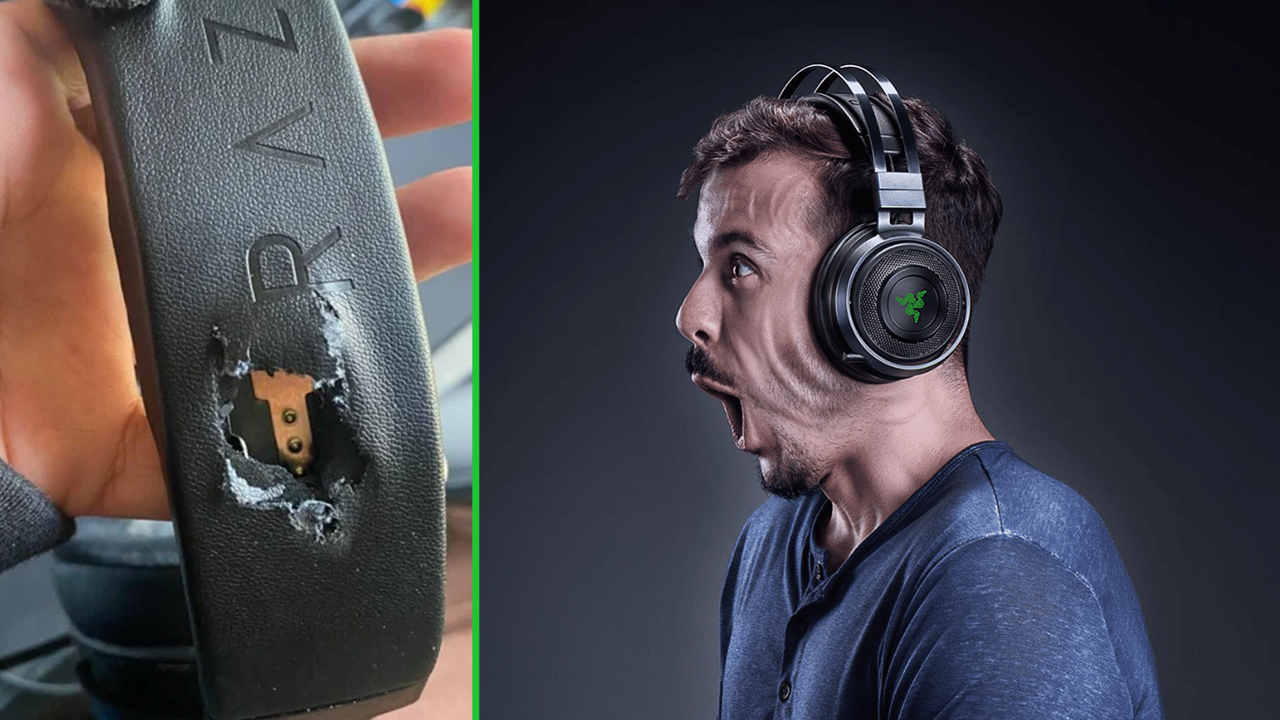 Νεαρός gamer χτυπήθηκε στο κεφάλι από αδέσποτη σφαίρα, λέει ότι σώθηκε επειδή φορούσε ακουστικά