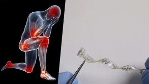 Επιστήμονες έφτιαξαν εμφύτευμα που απαλλάσσει από κάθε πόνο χωρίς φάρμακα (ΒΙΝΤΕΟ)
