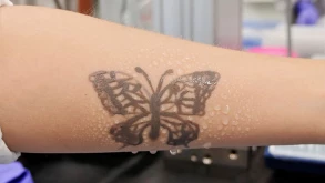 Τα e-tattoo μπορούν να παρακολουθούν την υγεία μας