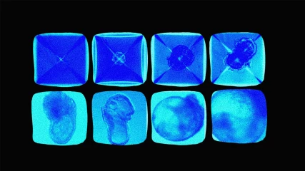 Επιστήμονες δημιούργησαν συνθετικά έμβρυα! (ΕΙΚΟΝΕΣ+ΒΙΝΤΕΟ)