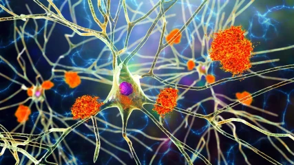 Δύο κοινοί ιοί είναι υπεύθυνοι για την πρόκληση Αλτσχάιμερ